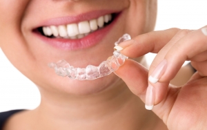 tooth-whitening